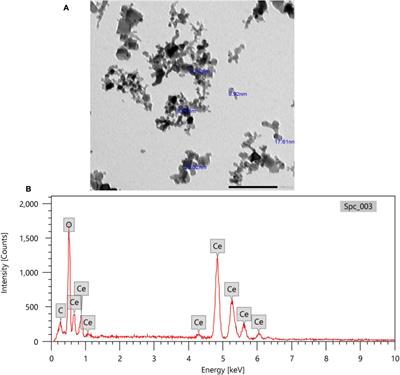 Ameliorative Role of Cerium Oxide Nanoparticles Against Fipronil Impact on Brain Function, Oxidative Stress, and Apoptotic Cascades in Albino Rats